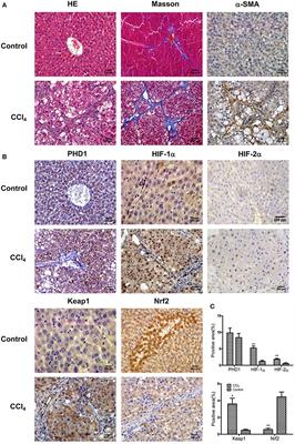 Double Knockdown of PHD1 and Keap1 Attenuated Hypoxia-Induced Injuries in Hepatocytes